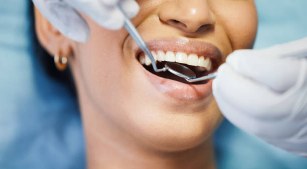 Best Cosmetic Emergency Dentistry in Butler, OH